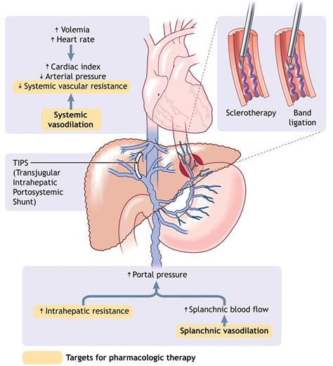 Esophageal Varices - Causes, Symptoms, Grading, Diagnosis, Treatment