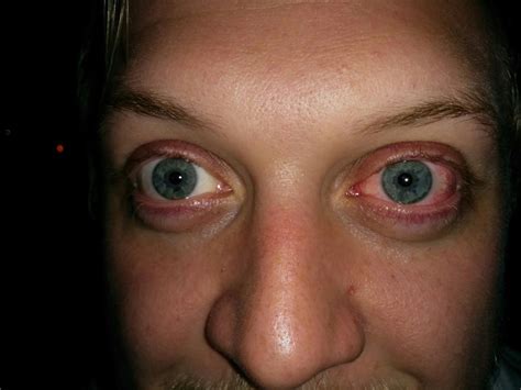 How Can You Tell if Someone Is High on Drugs?