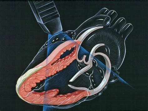 Doppler echocardiography procedure | Vinmec