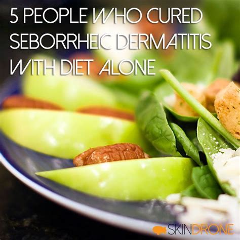 5 People Who Cured Seborrheic Dermatitis with Diet Alone | Home ...