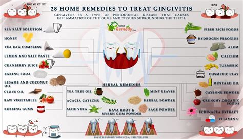 28 Home Remedies to Treat Gingivitis - Home Remedies