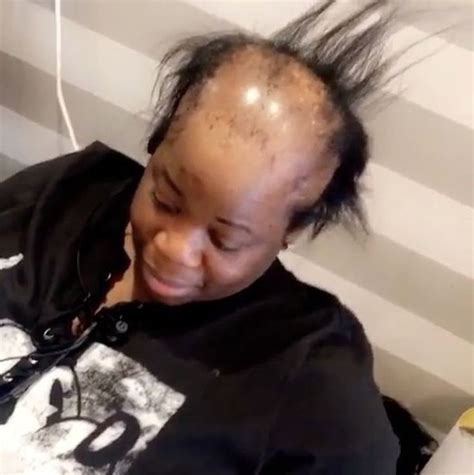 Inspiring Makeover for Woman with Alopecia