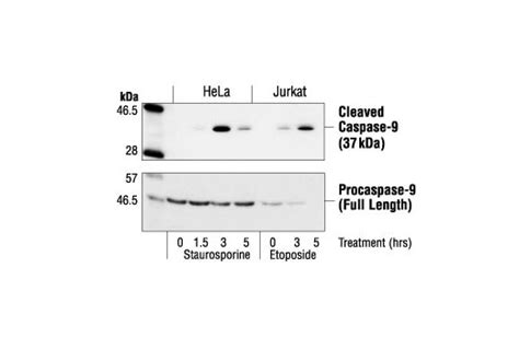 Cleaved Caspase-9 (Asp330) Antibody (Human Specific) | Cell Signaling Technology