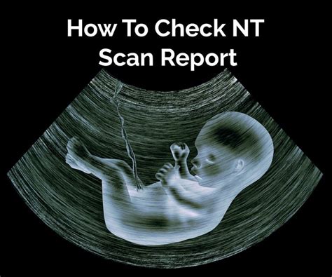 3 Month NT Scan Report Explained: Valuable Insights to Read Results