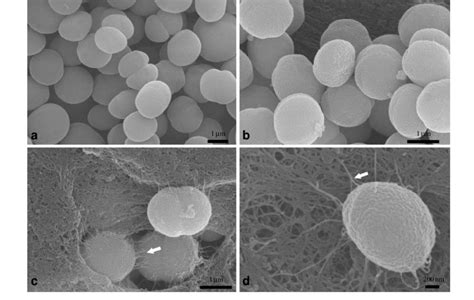 Conventional SEM images of Synechocystis sp. PCC 6803 prepared by ...