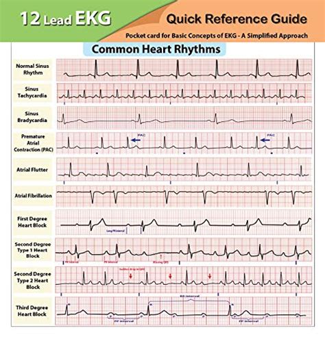 Buy EKG Pocket Card Cards – January 1, 2016 Online at desertcartGB