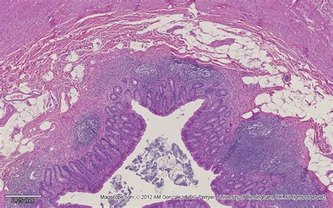 Histology Of Appendix