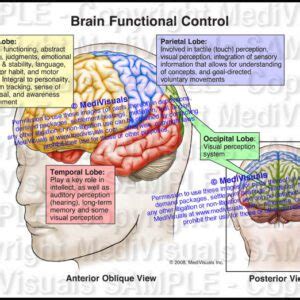 Intracranial Pressure Monitor Placement - Medivisuals Inc.