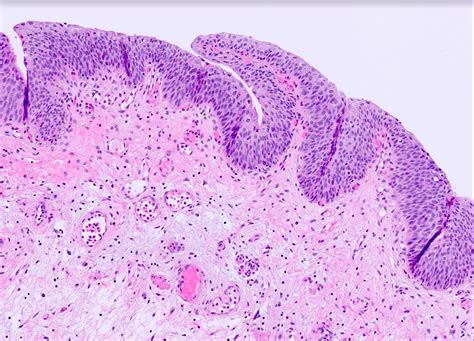 Urinary Bladder Histology Submucosa