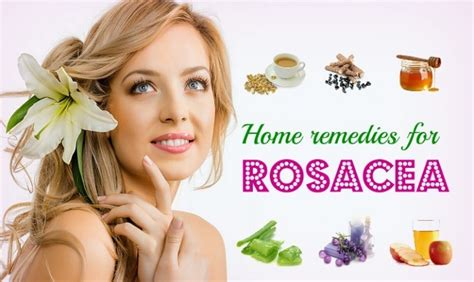 10 Best natural home remedies for rosacea - Yabibo