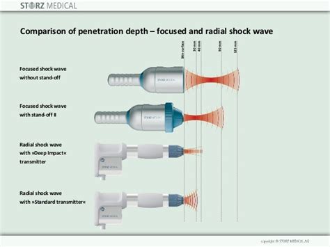 Physics of shock waves