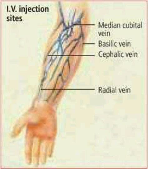 Iv Injection Sites Diagram Arm Angles Of Administration Of I