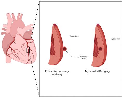 A Contemporary Review of the Genomic Associations of Coronary Artery ...