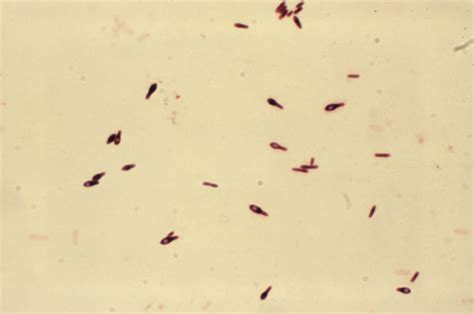 Free picture: gram, micrograph, clostridium botulinum, type ...