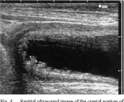 Figure 4 from Diagnostic ultrasound of polypoid cystitis in dogs ...