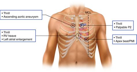 Introduction to Cardiac Auscultation | SpringerLink