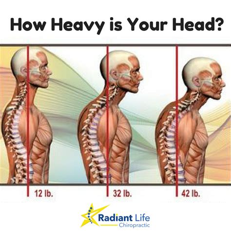 Forward Head Posture