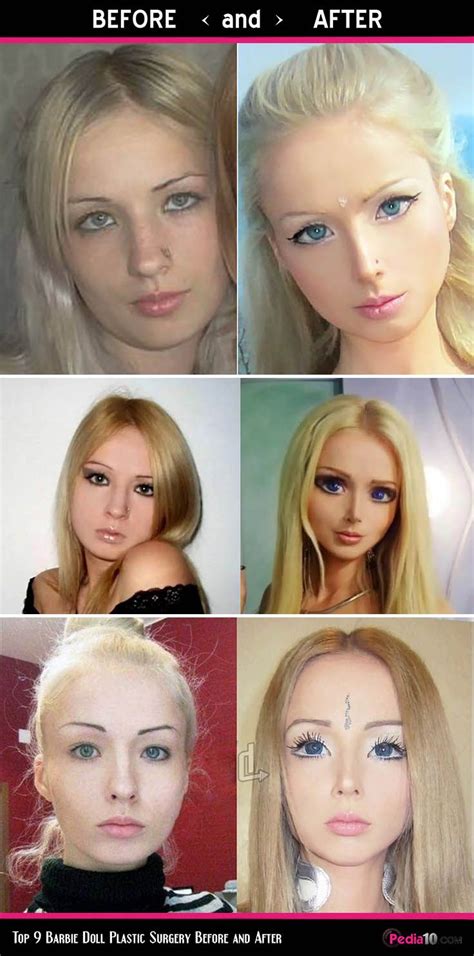 Valeria Lukyanova - Barbie Doll Plastic Surgery Before and After | Plastic surgery, Lip surgery ...