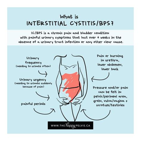 Men and Interstitial Cystitis - The Happy Pelvis