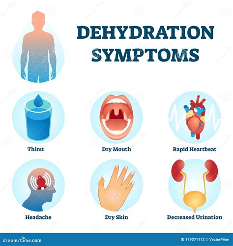 Illustration Vectorielle Des Symptômes De Déshydratation. Système De Diagnostic Des Déficits D ...