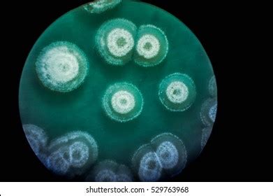 2,989 Germs under microscope Images, Stock Photos & Vectors | Shutterstock