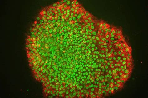 CellNEWS: Scientists find that SCNT Derived Cells and iPS Cells are Similar