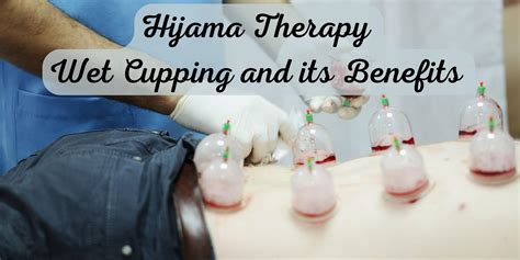 Hijama Therapy: Wet Cupping and its Benefits - yesmaam