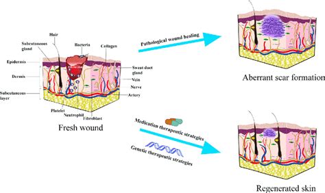 Remodeling of the wound, and the two kinds of outcomes. Scar formation... | Download Scientific ...