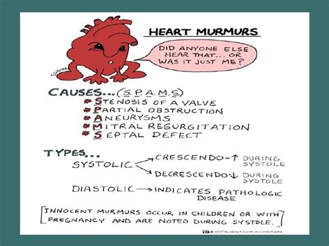 82 best images about HeARt MURmur ️ on Pinterest | Heart, Heart disease and Aortic stenosis