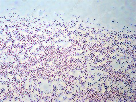 Haemophilus Influenzae Type B Gram Stain