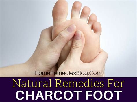 9 Effective Natural Treatments for Diabetic Charcot Foot - Home Remedies Blog