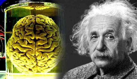 Albert Einstein Birthday Anniversary: Did you know Einstein’s brain was kept in a jar for 43 ...