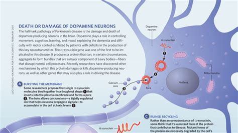 Death or Damage of Dopamine Neurons | The Scientist Magazine®