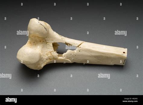 Distal Femur Anatomy