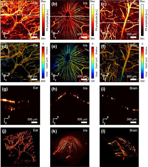 Handheld Photoacoustic Microscopy Probe | Scientific Reports