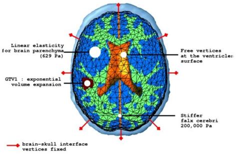 Health-e-Child - Brain Tumours