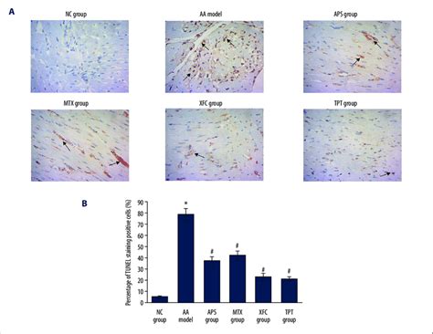 Evaluation of apoptosis by TUNEL staining. (A) TUNEL staining images... | Download Scientific ...