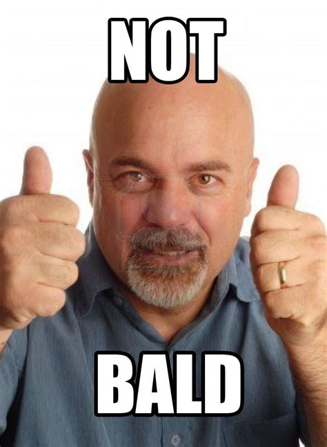 NOT BALD | "Not Bad" Obama Face | Rage faces, Balding, Bald man