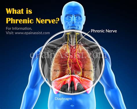 What Causes Phrenic Nerve Damage & How is it Treated?