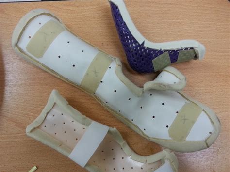 PencilKayu: Apa Itu Thermoplastic Splint | Occupational Therapy