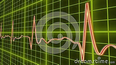 ECG Line Graph, Heart Beating In Normal Sinus Rhythm, Healthcare And Medicine Royalty-Free Stock ...