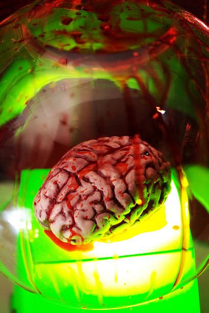 40+ Brain Autopsy Stock Photos, Pictures & Royalty-Free Images - iStock