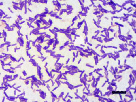 Clostridium Botulinum Gram Stain