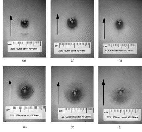 [PDF] Gunshot residue patterns on skin in angled contact and near contact gunshot wounds ...