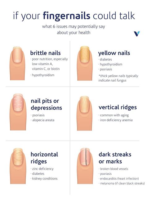 What Your Fingernails Say About Your Health | What's Good by V ...