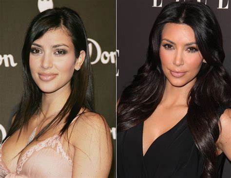 Makeup and Styles: Kim Kardashian Before and After Surgery