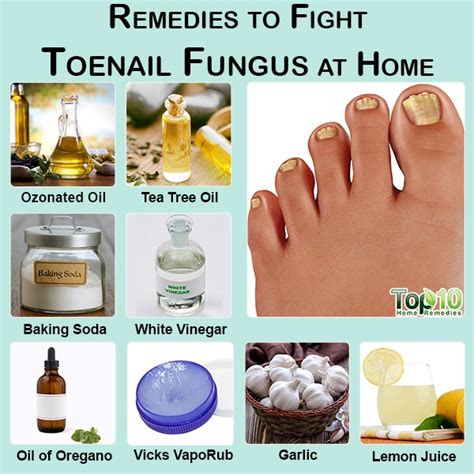 10 Remedies to Fight Toenail Fungus at Home | Top 10 Home Remedies