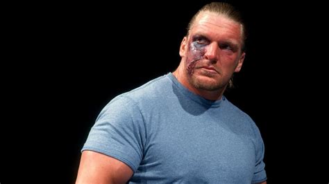 Five times WWE pushed crazy injuries like Rey Mysterio's popped out eye including The Rock ...