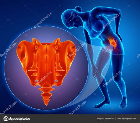 3d illustration of sacrum bone pain Stock Photo by ©pixdesign123 145338433