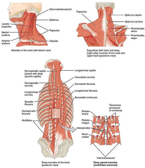 Dropped Head Syndrome associated with Motor Neurone Disease - Physiopedia